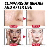 Tartaric Acid Facial Care Solution For Smoothing And Firming Skin